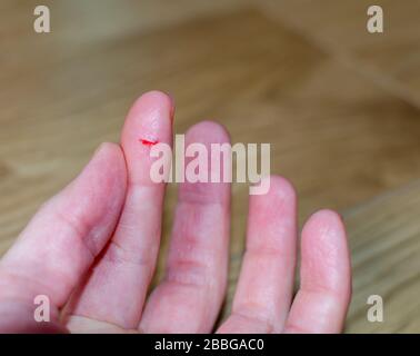 Bleeding from sharp cut wound at left index. Finger cut, bleeding injured with knife. Stock Photo