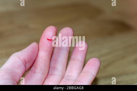 Bleeding from sharp cut wound at left index. Finger cut, bleeding injured with knife. Stock Photo