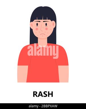 Girl with eczema on face illustration Stock Vector Image & Art - Alamy