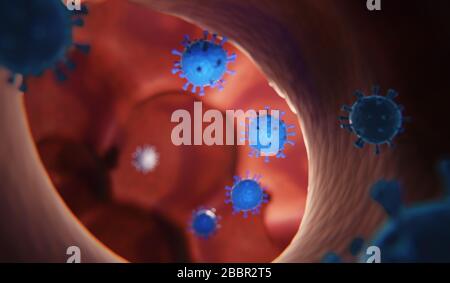 Corona virus or Covid-19 infected human lungs - digital 3d concept Stock Photo