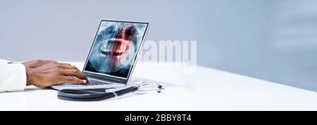 Close-up Of A Dentist's Hand Typing On Laptop With Dental X-ray On Screen Stock Photo
