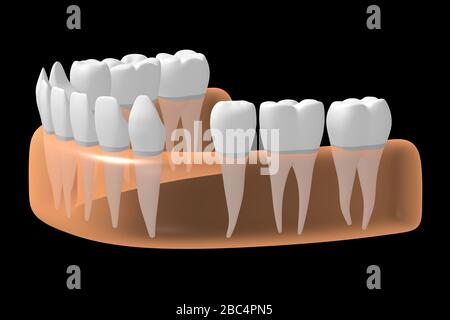 Missing tooth Stock Photo