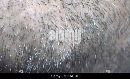 Chin bristles. A bearded old man touches his unshaven face with his hand. Unshaven a few days. The hair on the face of a man, a short beard Stock Photo