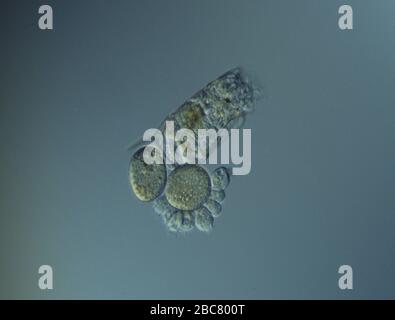 Rotifers swim in the water under the microscope Stock Photo - Alamy