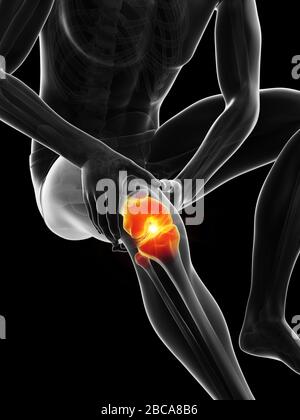 Painful knee, illustration. Stock Photo