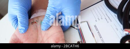 The doctor examines the healing wound of the patient on the hand palm scarring healing Stock Photo