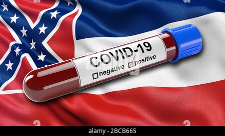 US state flag of Mississippi waving in the wind with a positive Covid-19 blood test tube. Stock Photo