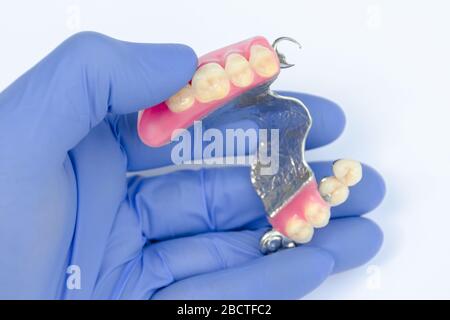 upper denture in the hands of a dentist. blue glove. clasp prosthesis. false teeth. ceramic-metal crowns Stock Photo