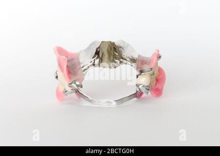 set of partial removable clasp clasps on the upper and lower jaws Stock Photo