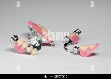 set of partial removable dentures of false teeth on the upper and lower jaws Stock Photo