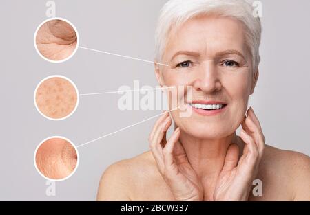 Face with signs of aging of an elderly woman. Aging skin Stock Photo ...