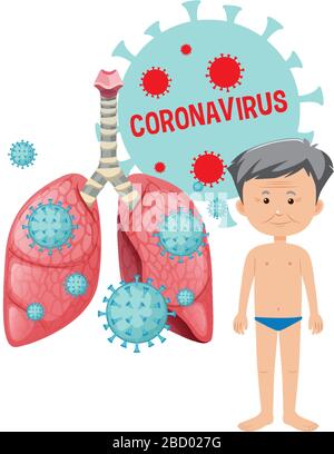 Coronavirus poster design with sick man and cells in lungs illustration Stock Vector