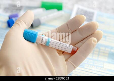 Blood sample test and empty tube blood for blood test screening with blank label for text in laboratory. blood test for coronavirus in the hospital. P Stock Photo