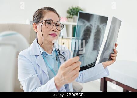 Chest x-ray of a mature female with pneumonia. side view Stock Photo ...