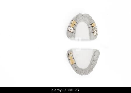Orthopedic dentistry background. dental prosthetics background. concept of artificial teeth. teeth isolated Stock Photo