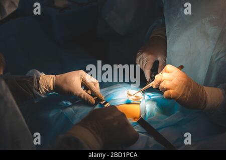 Close-ups of doctor's hands in medical gloves during surgery Stock Photo