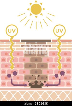 mechanism of skin pigmentation / skin spot illustration Stock Vector ...