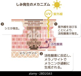 mechanism of skin pigmentation / skin spot illustration Stock Vector