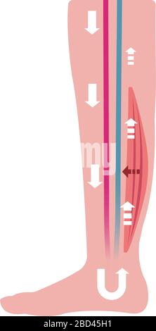 Cause of swelling(edema) of the legs. Decreased blood flow due to muscle weakness. flat illustration. Stock Vector
