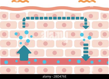 Illustration of swollen skin condition (Malfunction of moisture ...