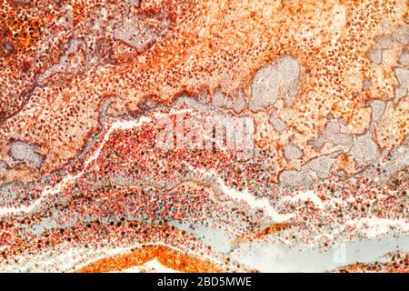 Fat heart tissue under the microscope 200x Stock Photo