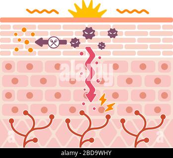 Generation mechanisim of athlete's foot ( ringworm) vector illustration ...