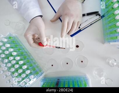 Top view of a researcher's hands in a laboratory drips a blood sample into a Petri dish. Focus on the dropper. Flu research and vaccine creation. Stock Photo