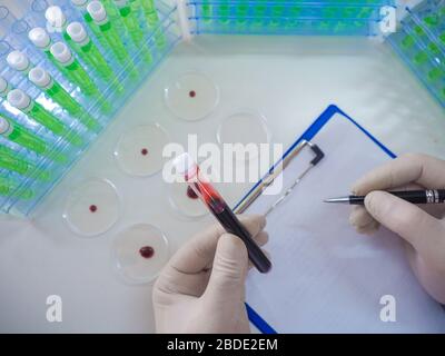 Researcher looking on diseased blood sample in a test tube and make a notes. Vaccine creation. View from a researcher's eyes. Stock Photo