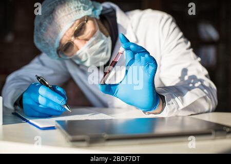 Close up view of blood sample in researcher's hands in test tube. Stock Photo