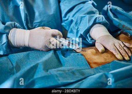 Surgical operation liposuction of the abdomen. Close-up of the patient on the operating table, surgical removal of adipose tissue from the abdomen Stock Photo