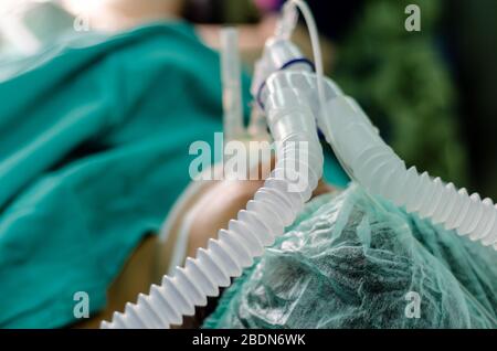 Patient with an endotracheal tube in operation theater,selective focus. Stock Photo