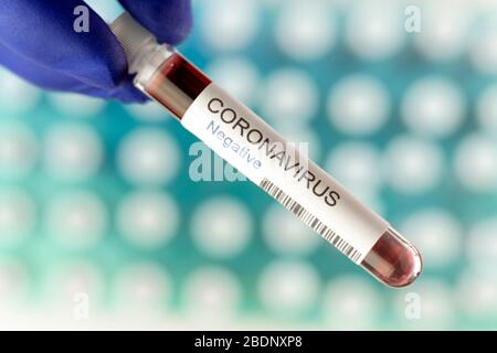 Negative result of coronavirus tests as symbol of an end of pandemic. Many blood test tube in special holder in the laboratory as background. Stock Photo