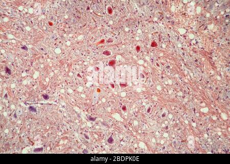 Brain cells tissue under the microscope 100x Stock Photo - Alamy