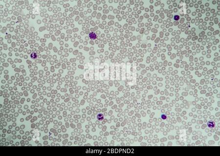 Red and white blood cells 400x Stock Photo