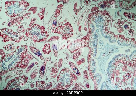 Infection with liver fluke tissue section 100x Stock Photo