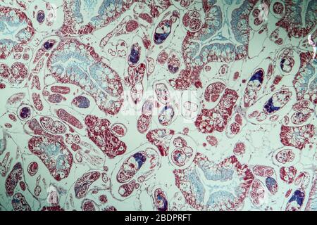 Infection with liver fluke tissue section 100x Stock Photo