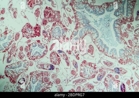 Infection with liver fluke tissue section 100x Stock Photo