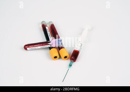 Syringe and test tube with blood isolated on white background Stock ...