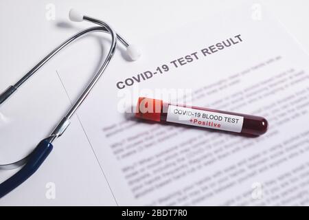 Positive test result for Coronavirus, rapid blood test for Coronavirus or Covid-19 pandemic Stock Photo