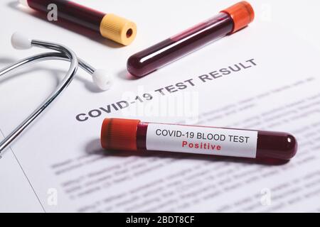 Positive test result for Coronavirus, rapid blood test for Coronavirus or Covid-19 pandemic Stock Photo