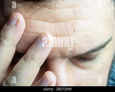 A close-up photo of a man leaning his fingers to his forehead, closing his eyes, showing a headache Stock Photo