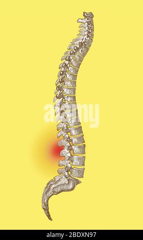 Lower Back Pain Stock Photo
