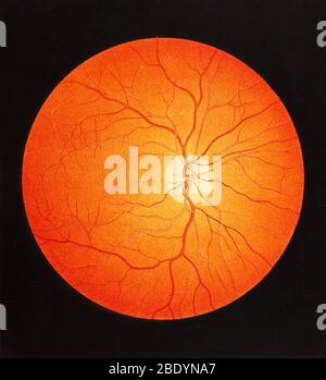 Normal fundus, illustration Stock Photo - Alamy