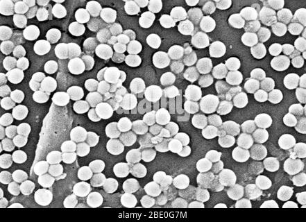 Numerous clumps of methicillin-resistant Staphylococcus aureus bacteria, commonly referred to by the acronym MRSA. Recently recognized outbreaks or clusters of MRSA in community settings have been associated with strains that have some unique microbiologic and genetic properties compared to the traditional hospital-based MRSA strains. This suggests that some biologic properties, e.g., virulence factors like toxins, may allow the community strains to spread more easily or cause more skin disease. A common strain named USA300-0114 has caused many such outbreaks in the United States. Staphylococc Stock Photo