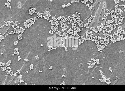 This scanning electron micrograph depicts a grouping of methicillin resistant Staphylococcus aureus (MRSA) bacteria. They are from one of the first isolates in the U.S. that showed increased resistance to vancomycin as well. Note the increase in cell wall material seen as clumps on the organism's surface. Recently recognized outbreaks or clusters of MRSA in community settings have been associated with strains that have some unique microbiologic and genetic properties compared to the traditional hospital-based MRSA strains. This suggests that some biologic properties, e.g., virulence factors li Stock Photo