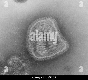 Negative-stained transmission electron micrograph (TEM) depicts the ultrastructural details of an influenza virus particle, or 'virion'. A member of the taxonomic family Orthomyxoviridae, the influenza virus is a single-stranded RNA organism. Stock Photo