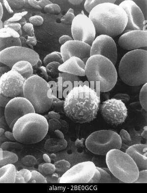 Blood cells and platelets. Scanning electron micrograph (SEM) of human blood showing red and white cells and platelets. Red blood cells (erythrocytes) have a characteristic biconcave-disc shape and are numerous. These large cells contain hemoglobin, a red pigment by which oxygen is transported around the body. They are more numerous than white blood cells one of which is visible in this sample. White blood cells (leukocytes) are rounded cells with microvilli projections from the cell surface. Leucocytes play an important role in the immune response of the body. Platelets are smaller cells that Stock Photo