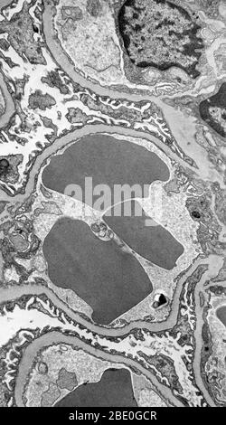 TEM of several red cells in cross-section within the capillary loop (any of the small blood vessels that carry blood in the papillae of the skin) of a glomerulus from the kidney of a mouse. The hemoglobin-containing red cells appear deeply gray and homogeneous because they contain no nuclei. Blood present in the capillary loop filters materials across the thin cellular processes of the endothelium (the gray amorphous basement membrane which surrounds the cells) and between the foot processes of specialized cells (podocytes) that line the urinary space. Magnification: x14,000. Stock Photo