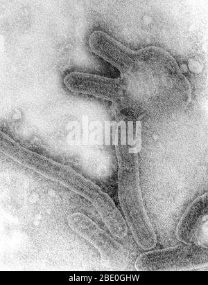 This negative stained transmission electron micrograph (TEM) depicts a number of Marburg virus virions, which had been grown in an environment of tissue culture cells. Marburg hemorrhagic fever is a rare, severe type of hemorrhagic fever which affects both humans and non-human primates. Caused by a genetically unique zoonotic (that is, animal-borne) RNA virus of the filovirus family, its recognition led to the creation of this virus family. The four species of Ebola virus are the only other known members of the filovirus family. After an incubation period of 5-10 days, the onset of the disease