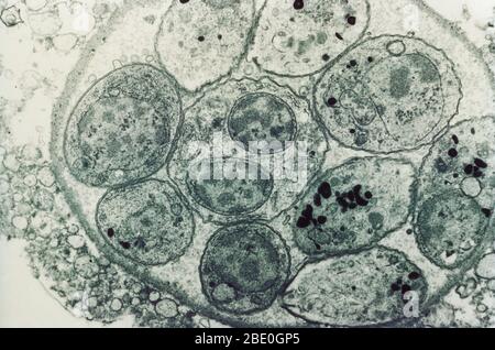 Transmission Electron Micrograph (TEM) showing Toxoplasma cyst. Toxoplasma is a parasitic protozoan that causes the disease Toxoplasmosis. Magnification unknown. Stock Photo